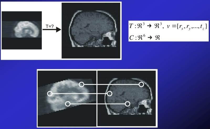 Matching PET and CT images