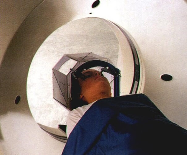 Badanie tomograficzne pacjenta z przymocowaną klatką pozycjonującą